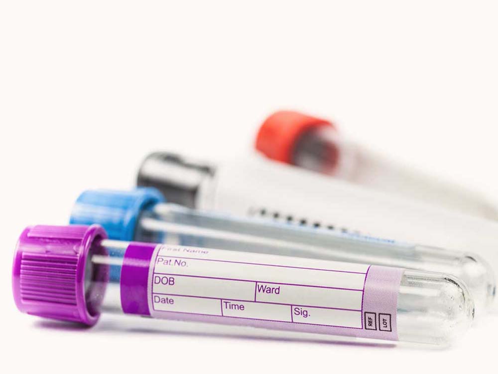 Blood Test Tube Colors in Kampala Uganda. Leading Medical Supplies Companies in Uganda, Hospital Equipment, Medical Supplies, Healthcare, Medicare, Dental Equipment, Clinical Equipment, Medical Devices, Medical Machinery, Diagnostic Equipment, Scientific, Laboratory, Medical Instruments, Medical Supply & Supplier Companies in Uganda, Ugabox