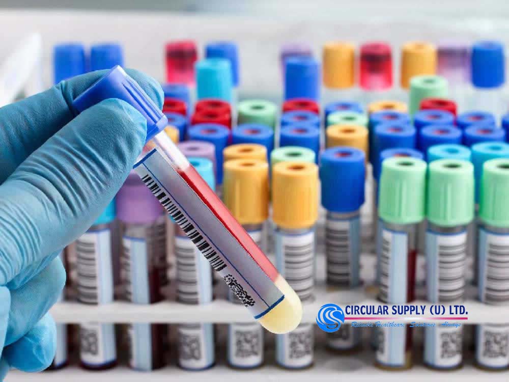 Blood Test Tubes Colors for Sale Kampala Uganda. Blood Collection Tubes Colors, Lab-Laboratory Consumables Medical Devices and Equipment Uganda, Medical Supply, Medical Equipment, Hospital, Clinic & Medicare Equipment Kampala Uganda. Circular Supply Uganda, Ugabox